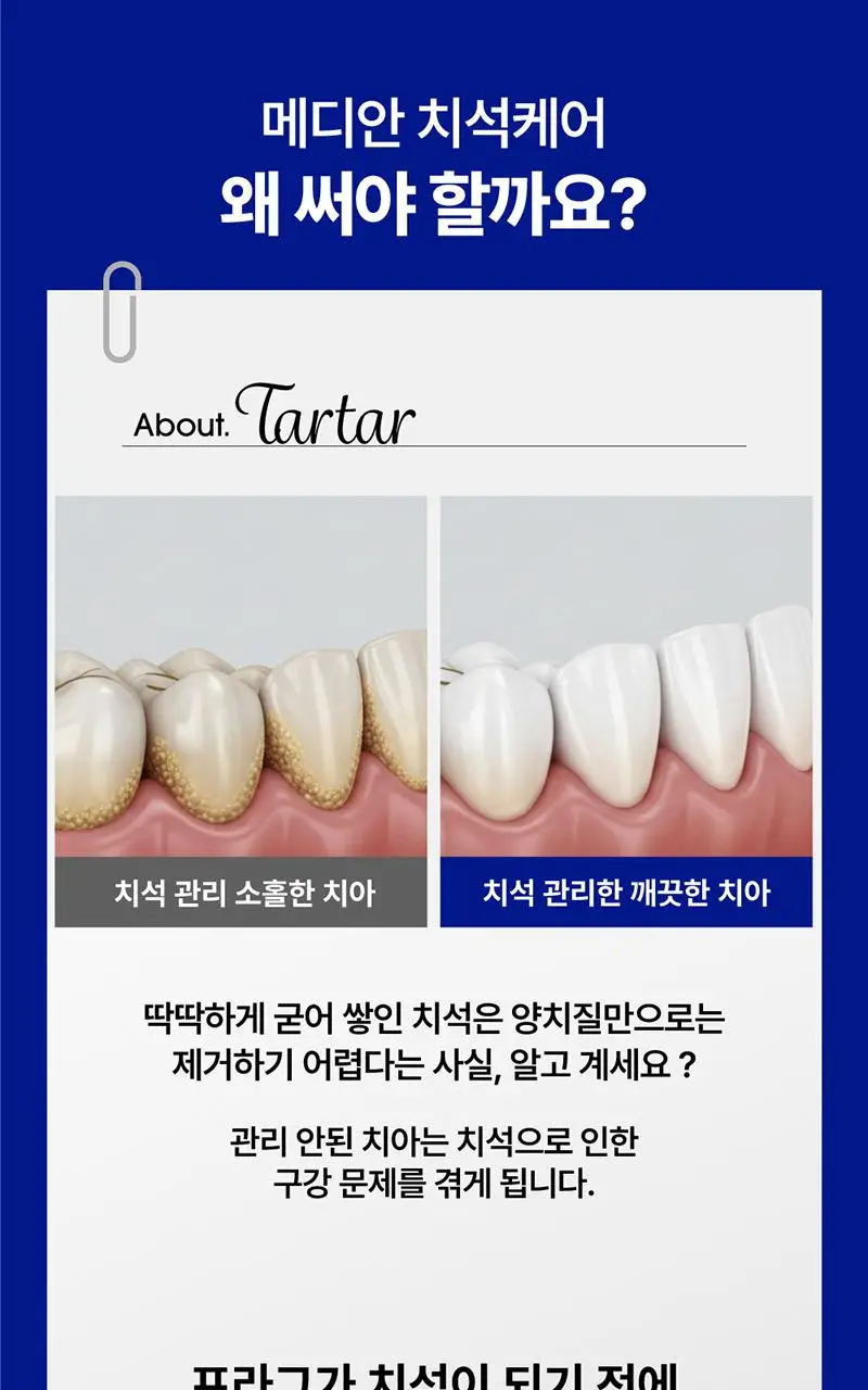 [불소 포함]메디안 치석케어 화이트 치약 120G 상세페이지 5